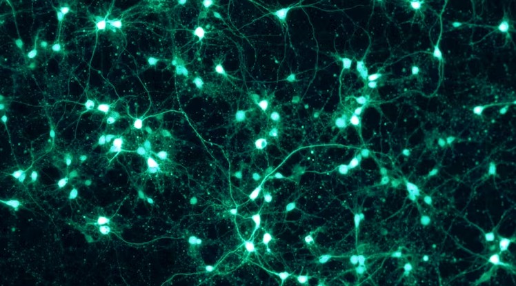 Dar una nueva vida a las neuronas para luchar contra el párkinson