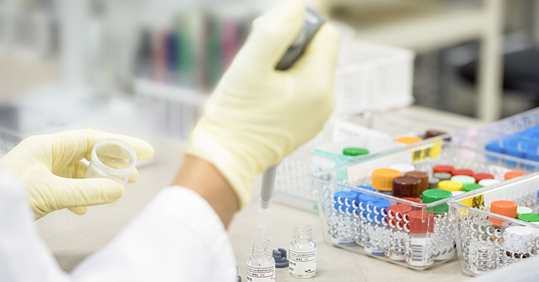 Sysmex y Fujirebio se asocian para impulsar pruebas de demencia a nivel global