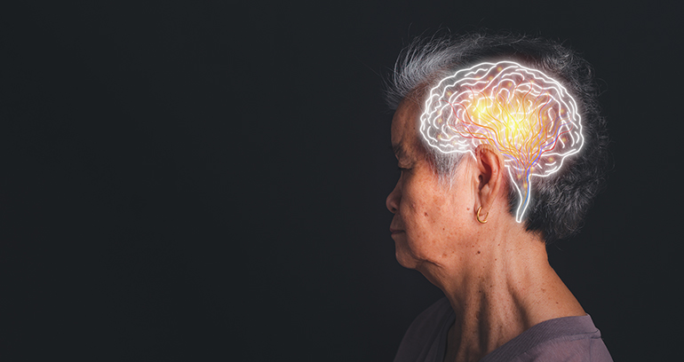 La planificación compartida, esencial para garantizar una atención digna en personas con demencia