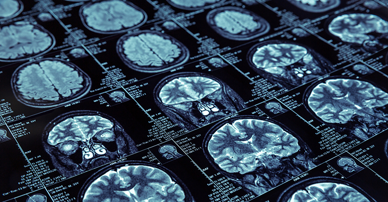 Consejos para viajar con personas con Alzheimer este verano