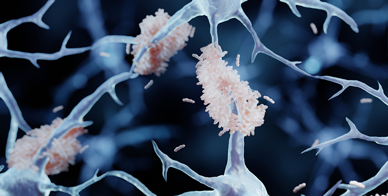Ace Alzheimer Center Barcelona impulsará la investigación sobre Alzheimer y demencias en África