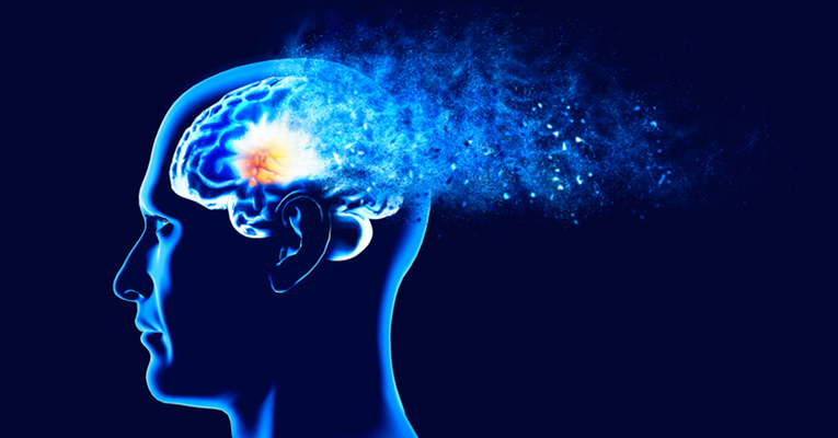 prevención Alzheimer