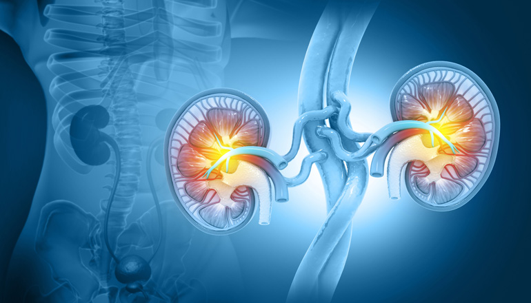 Más de un 10% de la población padece una Enfermedad Renal Crónica y su prevalencia aumenta en pacientes con hipertensión, diabetes, obesidad y de edad avanzada