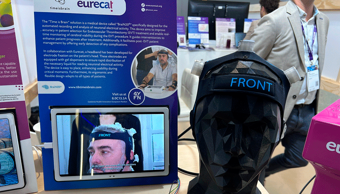 El Mobile World Congress muestra una diadema para registrar la actividad cerebral durante un ictus agudo y prever complicaciones