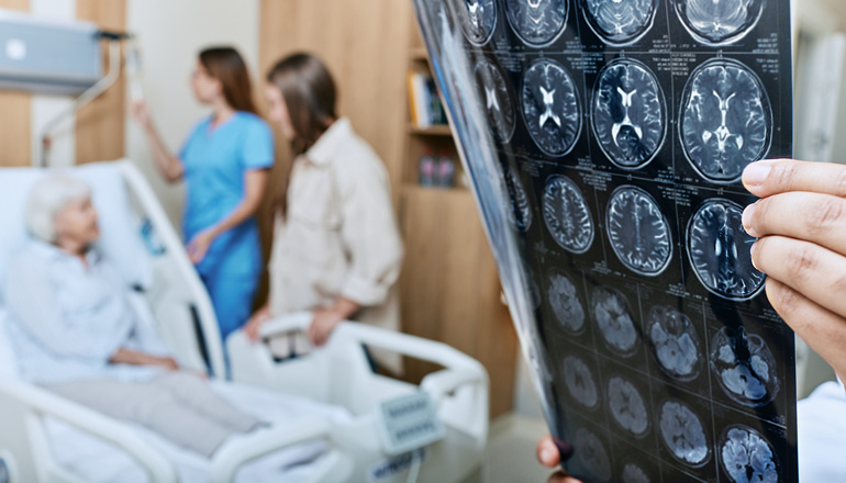 La aplicación de programas de salud cerebral ayudará a reducir la incidencia de las enfermedades neurológicas en España